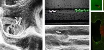 Tiny bots can deep clean teeth: Study