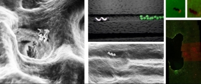 Tiny bots can deep clean teeth: Study