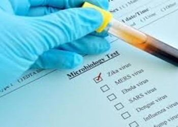 New smartphone clip-on may help detect Zika virus