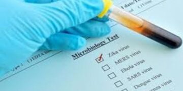 New smartphone clip-on may help detect Zika virus