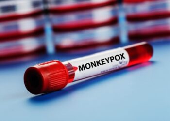 Explained: What is monkeypox, how does it spread, how to avoid