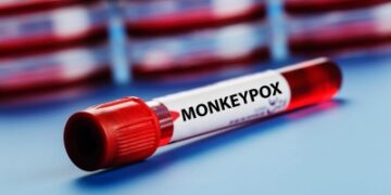 Explained: What is monkeypox, how does it spread, how to avoid
