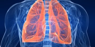 Researchers tests AI tool that predicts risk of lung cancer