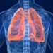 Researchers tests AI tool that predicts risk of lung cancer