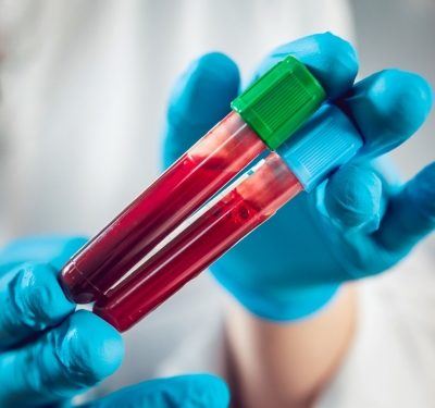 Potentially harmful chemicals found in blood of Tokyo citizens: Civic group