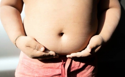 Childhood obesity in India likely to rise 9.1% annually by 2035: Report