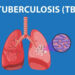 All Panchayats in Srinagar District declared TB-free