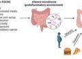‘New age epidemic’: 90 pc colorectal cancers preventable, says Onco surgeon