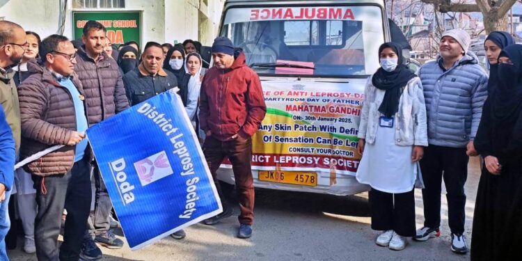 CMO Doda flags off Sparsh Leprosy Rally-cum-Awareness Van
