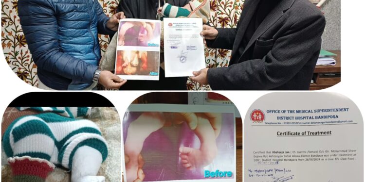 Certificate of Completion Issued for Clubfoot Treatment in DH Bandipora.