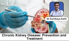 Chronic kidney disease cases double in a decade in J&K: Doctors